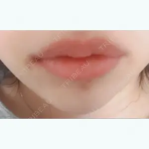 口コミ