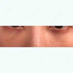 13 days after image