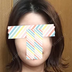 18 days after image