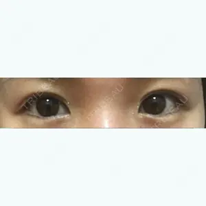 55 days after image