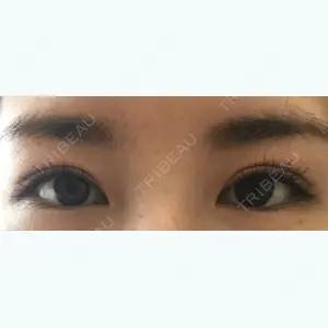 52 days after image
