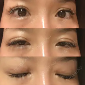 27 days after image