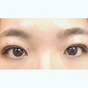4 days after image