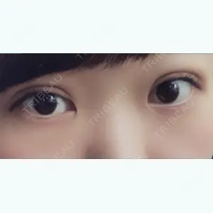 口コミ