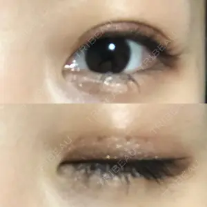 39 days after image
