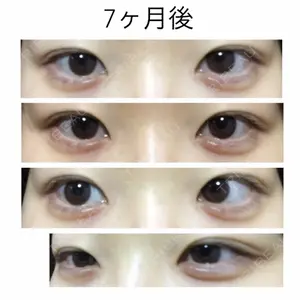 209 days after image