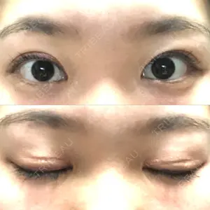 294 days after image