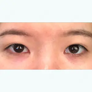 364 days after image