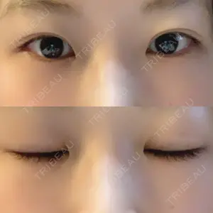 40 days after image