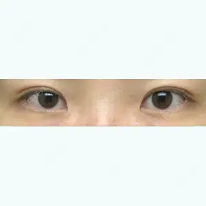 190 days after image
