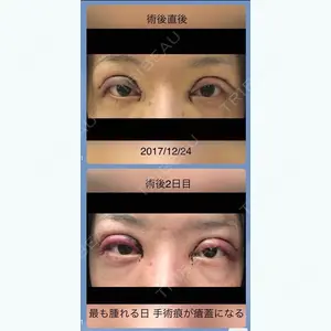 0 days after image