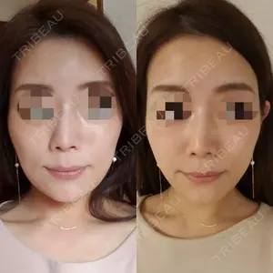 8 days after image