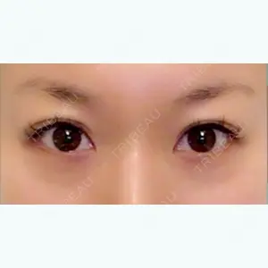 28 days after image