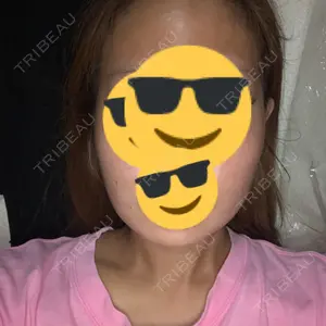 9 days after image