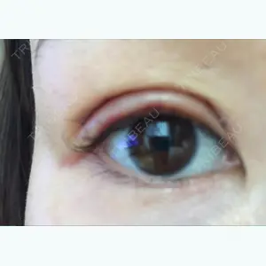 2 days after image