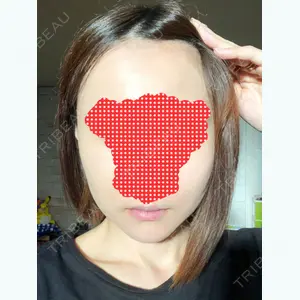 47 days after image