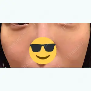 10 days after image