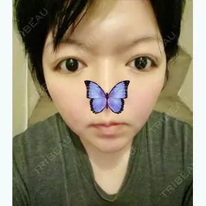 10 days after image