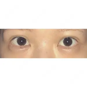 17 days after image