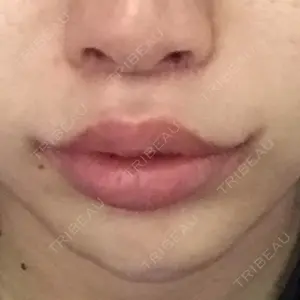 24 days after image