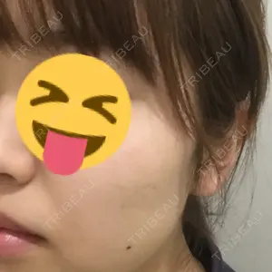 18 days after image