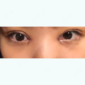 4 days after image