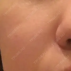 3 days after image