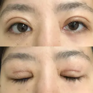 26 days after image