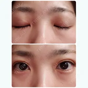 31 days after image