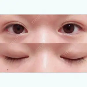 55 days after image