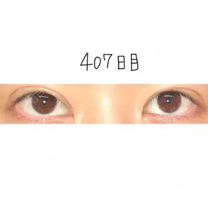 407 days after image