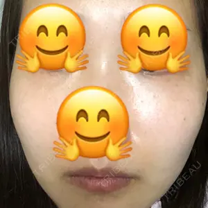 37 days after image