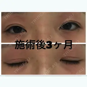 92 days after image