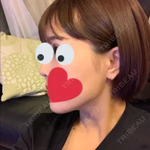 57 days after image