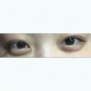 17 days after image