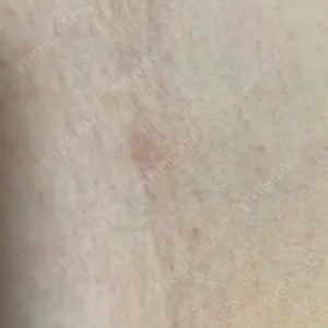 873 days after image