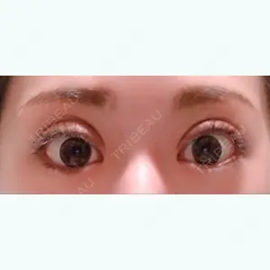 35 days after image