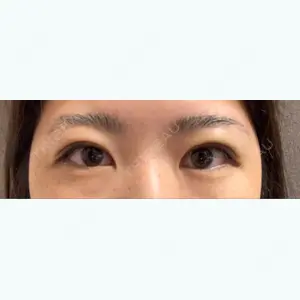 3 days after image