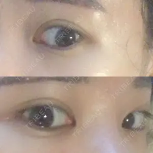 43 days after image