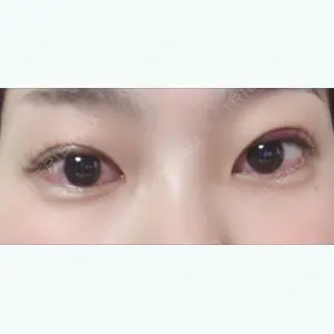 7 days after image