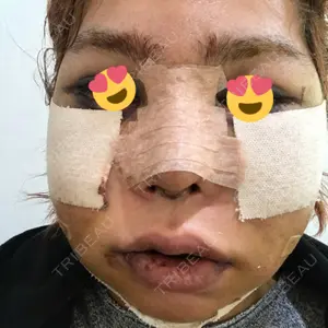 メイドヤング美容整形外科口コミ