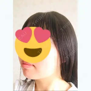 87 days after image