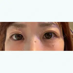 30 days after image