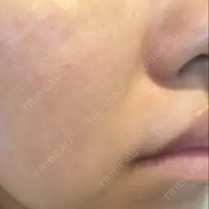 6 days after image