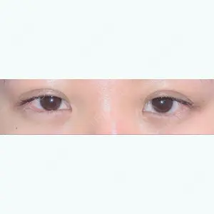 2 days after image
