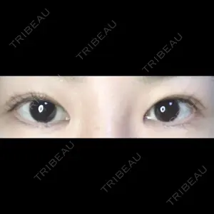 189 days after image