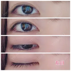 40 days after image
