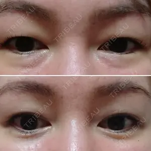 76 days after image