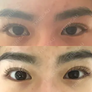 84 days after image