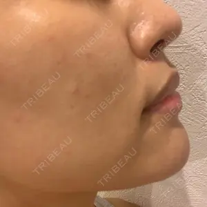 13 days after image